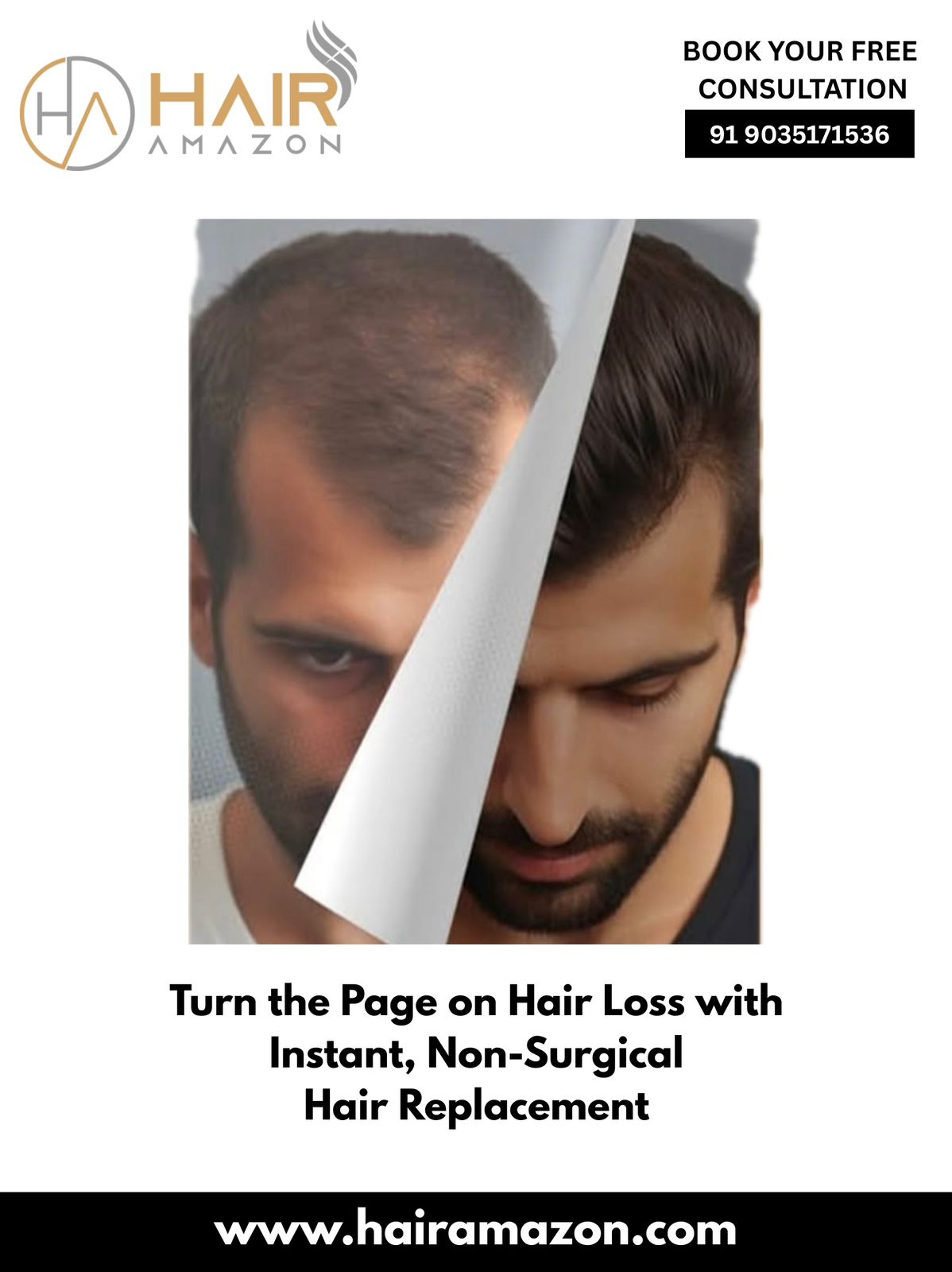 Hair Replacement in Koramangala
